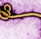 Ebola ruled out in Swedish patient suspected of having virus, hospital says